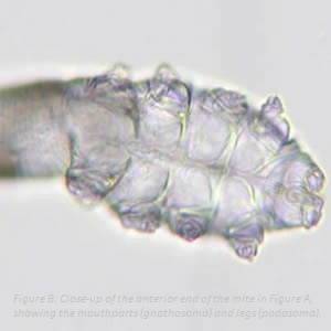 Do demodex mites cause acne and pimples?